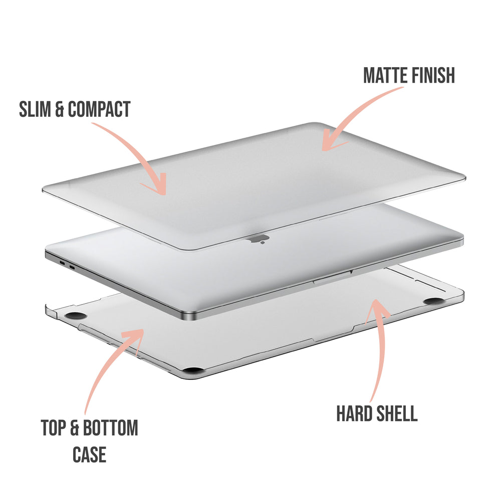 Tortoise Shell MacBook Case